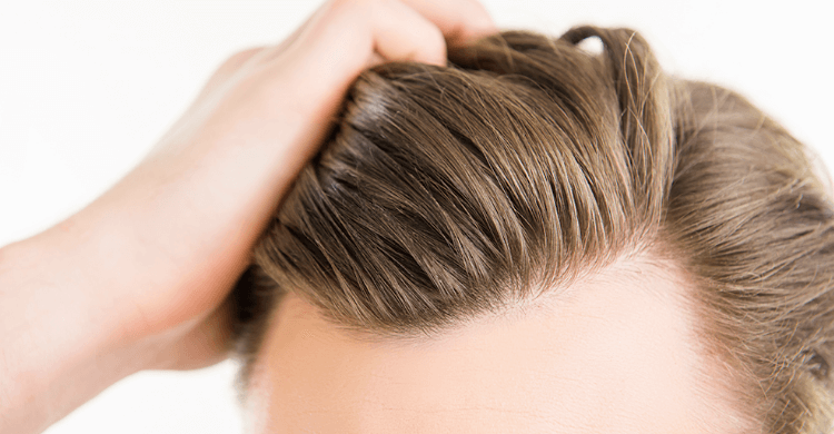 Warum viele Mittel gegen Haarausfall wirkungslos sind